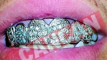 Bijuterii in loc de dinti, ultima moda printre vedete