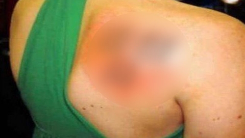 Nu i-a venit sa creada! A mers sa-si faca un tatuaj smecher. Cand s-a uitat in oglinda a inceput sa planga. "M-a nenorocit"