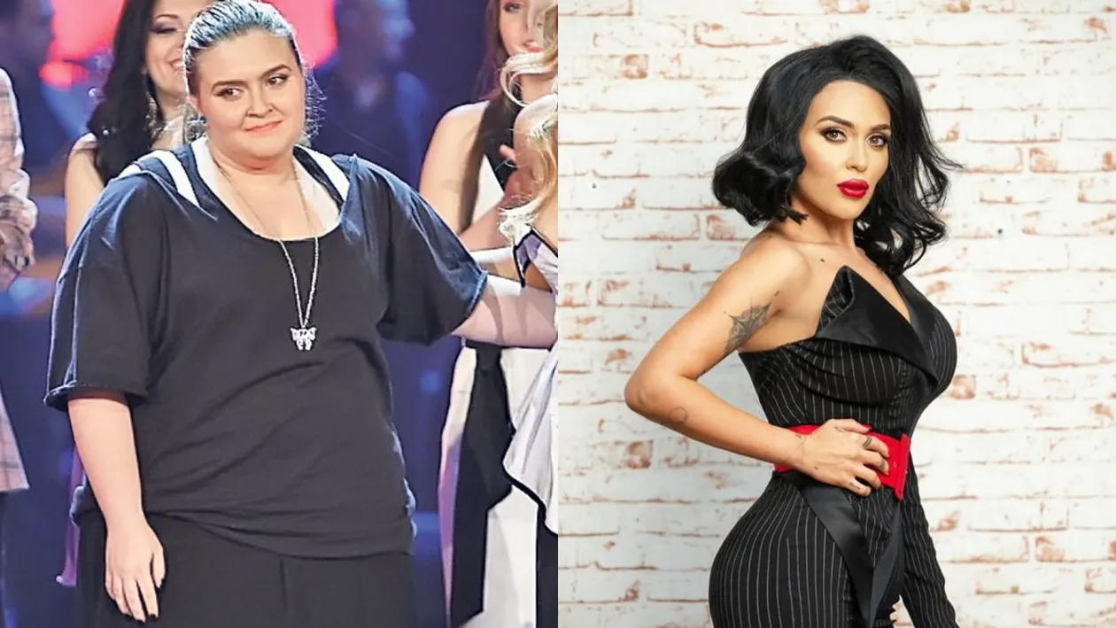 Oana Radu, pe mâna medicilor după ce a slăbit spectaculos. La ce intervenție va fi supusă artista