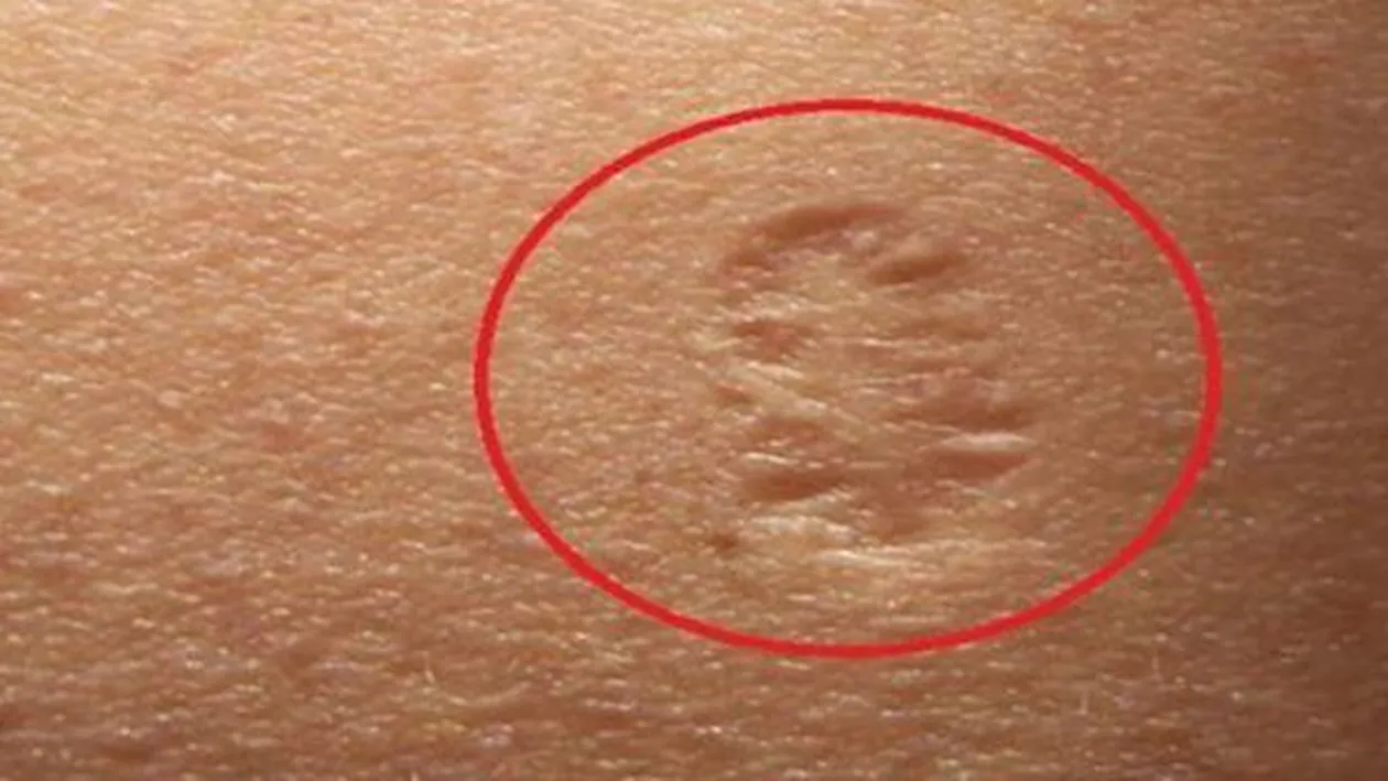 Ai si tu acest semn pe braţ? Asta este adevărata semnificaţie! Cei mai mulţi s-au căpătuit cu el înainte de ...