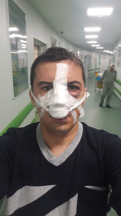 Ce s-a întâmplat cu polițiștii bătuți de un clan de rromi din Vâlcea