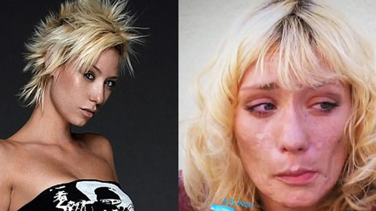 Transformarea socanta a unui fotomodel - drogurile i-au distrus viata! A ajuns pe strazi, are trupul plin de rani si dintii ii putrezesc