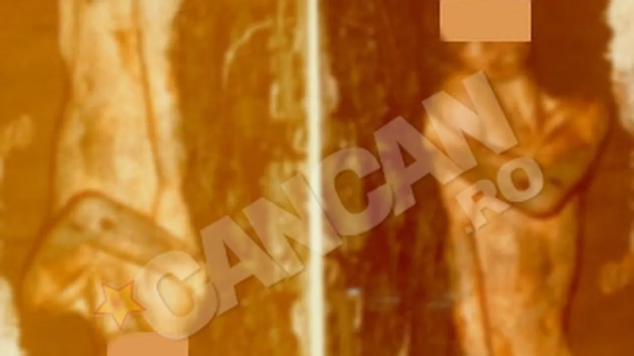 Csampar, vanatorul de oameni