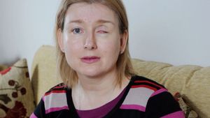 FOTOGRAFII ŞOCANTE! O mamă a doi copii şi-a pierdut un ochi din cauza lentilelor de contact!