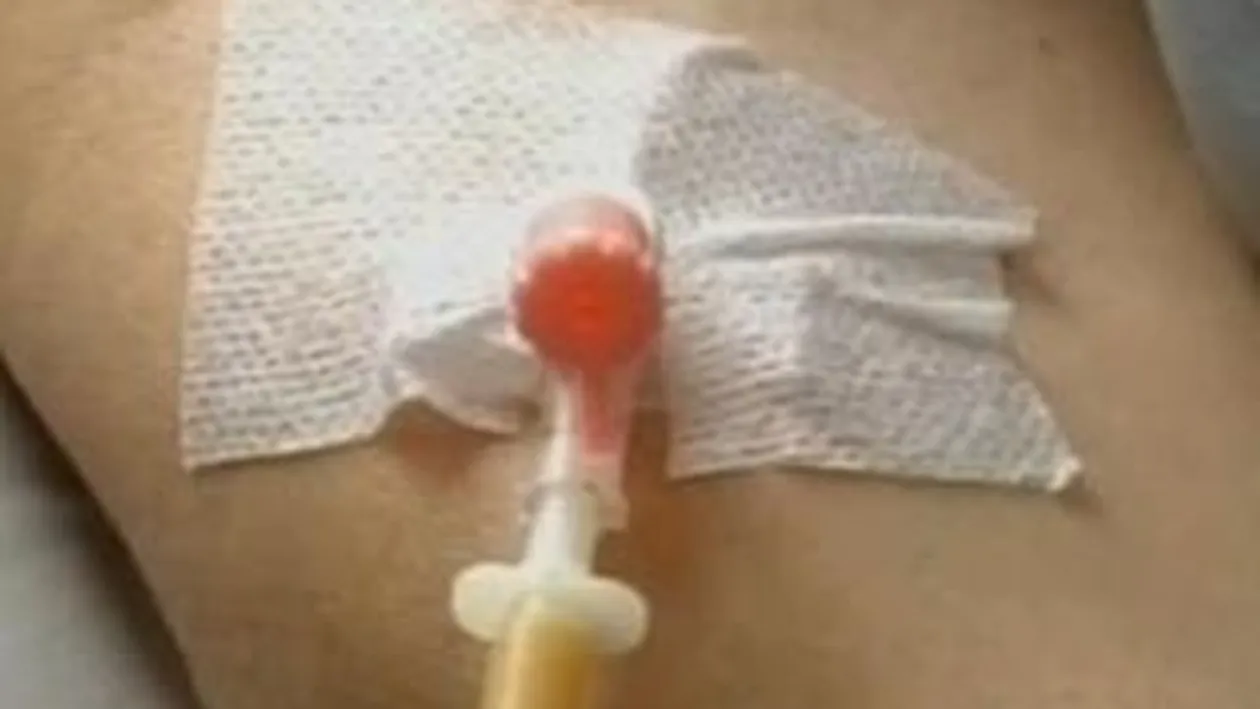 Un tanar din Sibiu a fost muscat de o capusa si acum este suspect de encefalita!