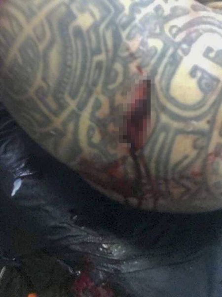 Bebino a ajuns la spital în stare gravă, după un măcel în toată regula, cu săbii și cuțite