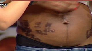 Video INCREDIBIL! Uite in ce hal a fost mutilata Laurette la salonul de infrumusetare - Are carne vie pe abdomen