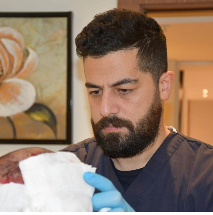 Legacy Med aduce în România inovație în transplantul de păr: implant de păr pentru femei fără a tunde podoaba capilară. Colaborare specială cu Turkey Hair Academy
