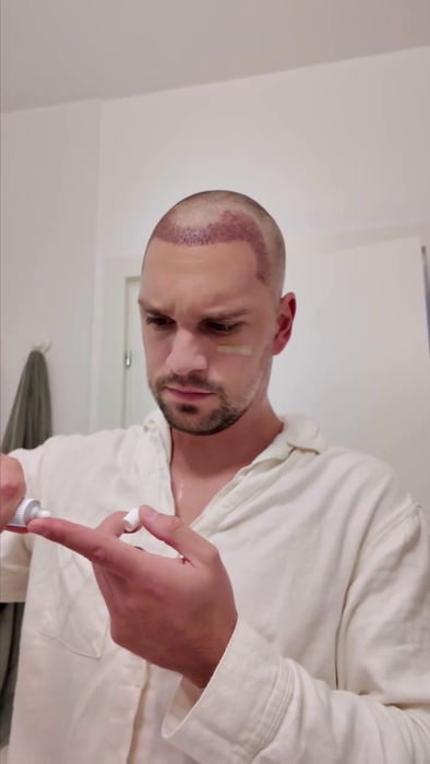 Vlad Gherman, după implantul de păr/ Sursa foto: Instagram