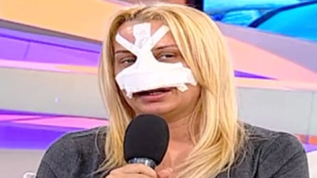 E blonda, celebra, dar asta n-o multumeste! Ea a pierdut numarul operatiilor estetice, insa noi ii tinem evidenta