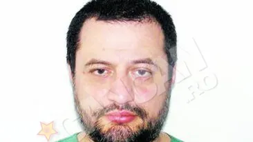 Paralizia fetei, corectata chirurgical