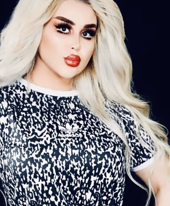 Dalia a vrut să arate ca păpușa Barbie, dar rezultatul i-a șocat pe apropiați. După 43 de operații, tânăra de 30 de ani este asemănată cu un zombi