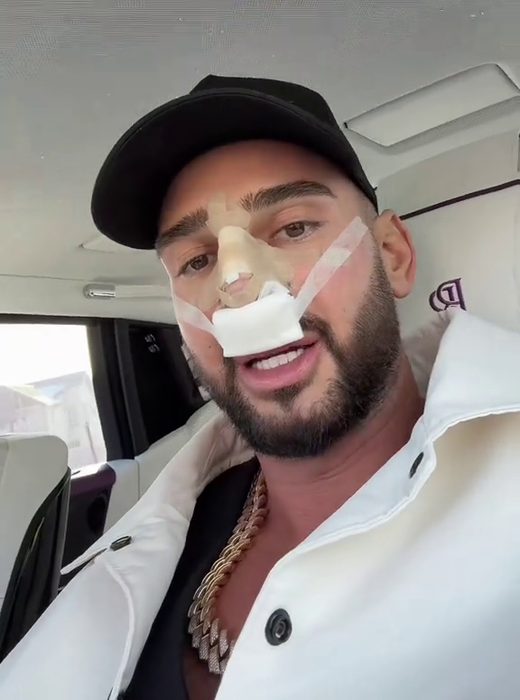 Dorian Popa, la un pas să îi „cadă nasul ca lui Michael Jackson”! Ce i-a descoperit medicul la operație? „Habar nu aveam”