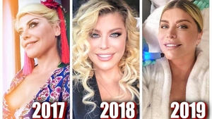 Loredana Groza a vorbit despre operațiile estetice pe care le are