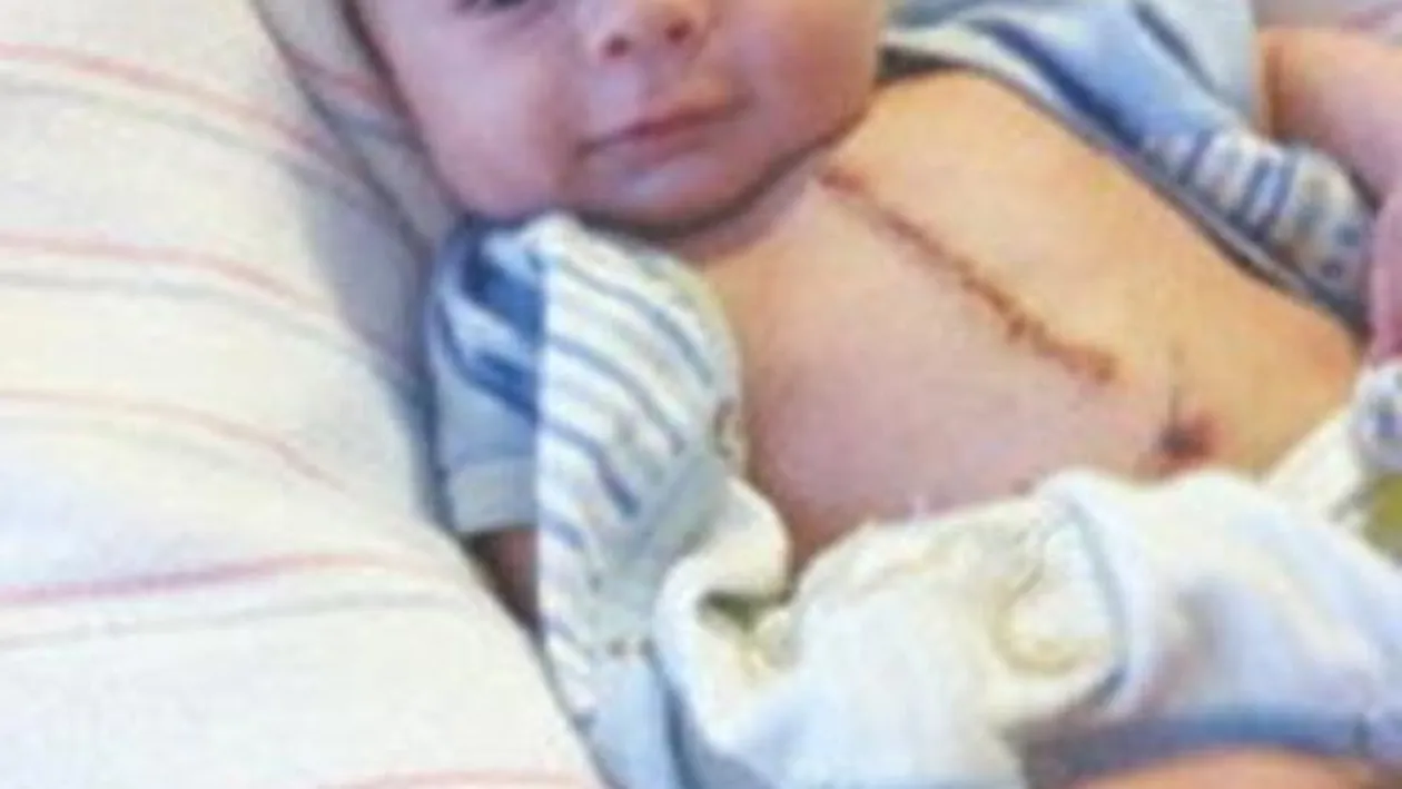 Lecţie de viaţă dată de un bebeluş de numai trei luni! A suferit enorm şi a găsit puterea să zâmbească după atâta durere