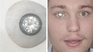 Povestea tânărului care și-a pus un diamant de 2 milioane de dolari în loc de ochi: ”A adus o lumină nouă în viața mea”