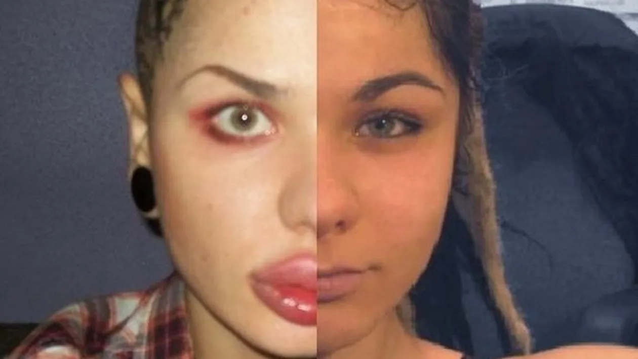 Trup de ZEITA, chip de DIAVOL! Cum ARATA aceasta tanara INAINTE sa recurga la aceste operatii EXTREME