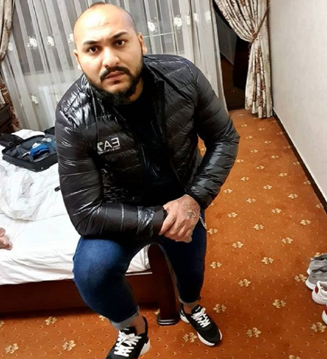 Dani Mocanu, inainte de implantul de par
