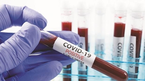 Coronavirus România, 27 februarie. 54 de decese s-au înregistrat în ultimele 24 de ore