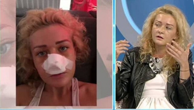 SANDRA, „blonda lui TUNCAY“, desfigurată! I-a dat cu piciorul în faţă, când pleca din club