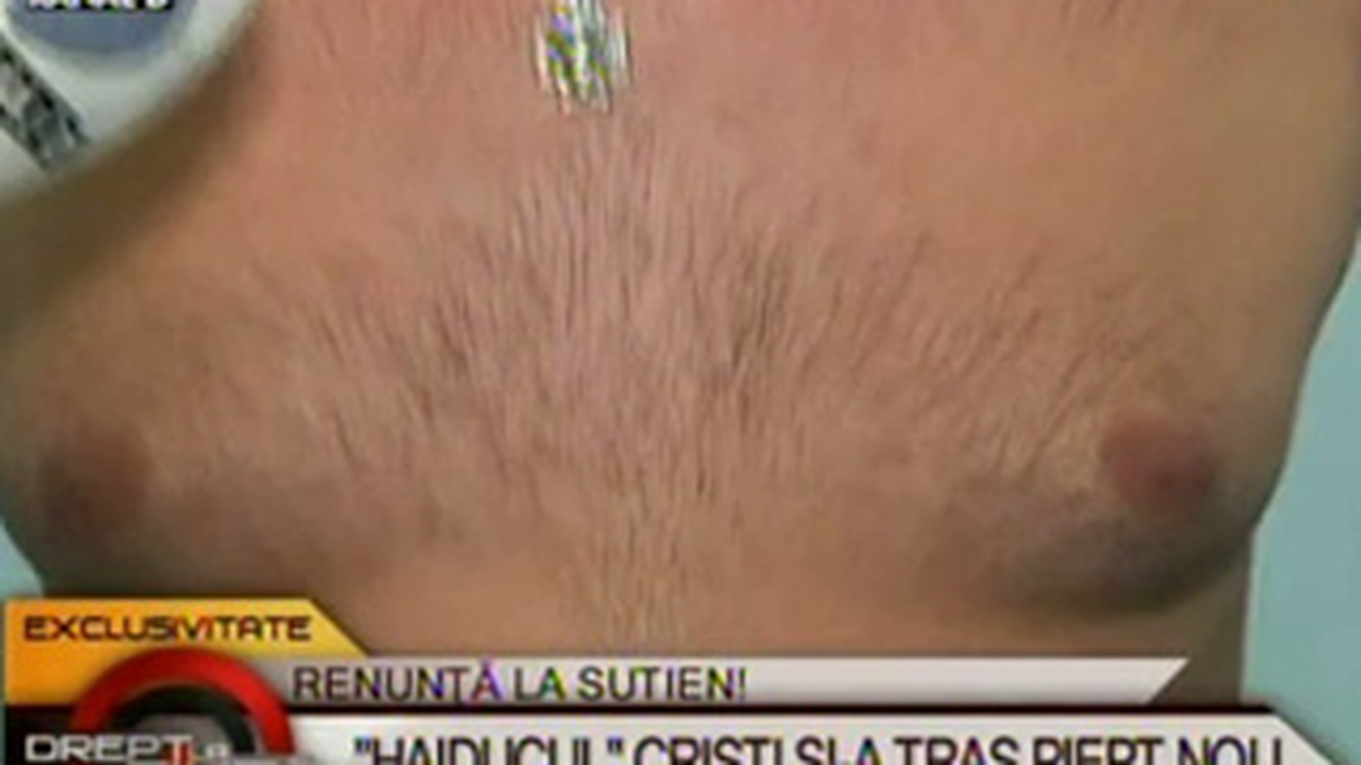 VIDEO Si-a operat sanii! Cristi de la "Haiducii" s-a saturat de cupa B si si-a modelat pectoralii pentru a arata mai bine!
