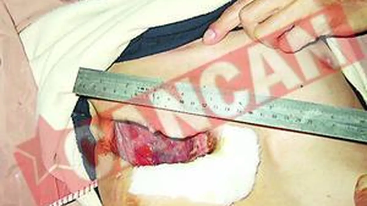 A trait zece ani cu o gaura in piept