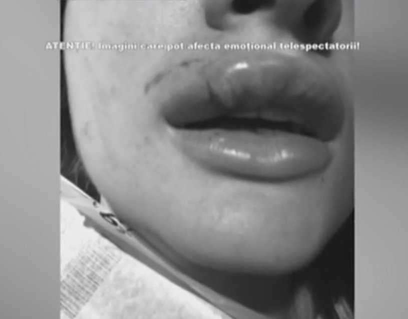 Geanina Manea, fosta iubită a lui Petru Mircea, mutilată! Atenţie, imagini şocante!