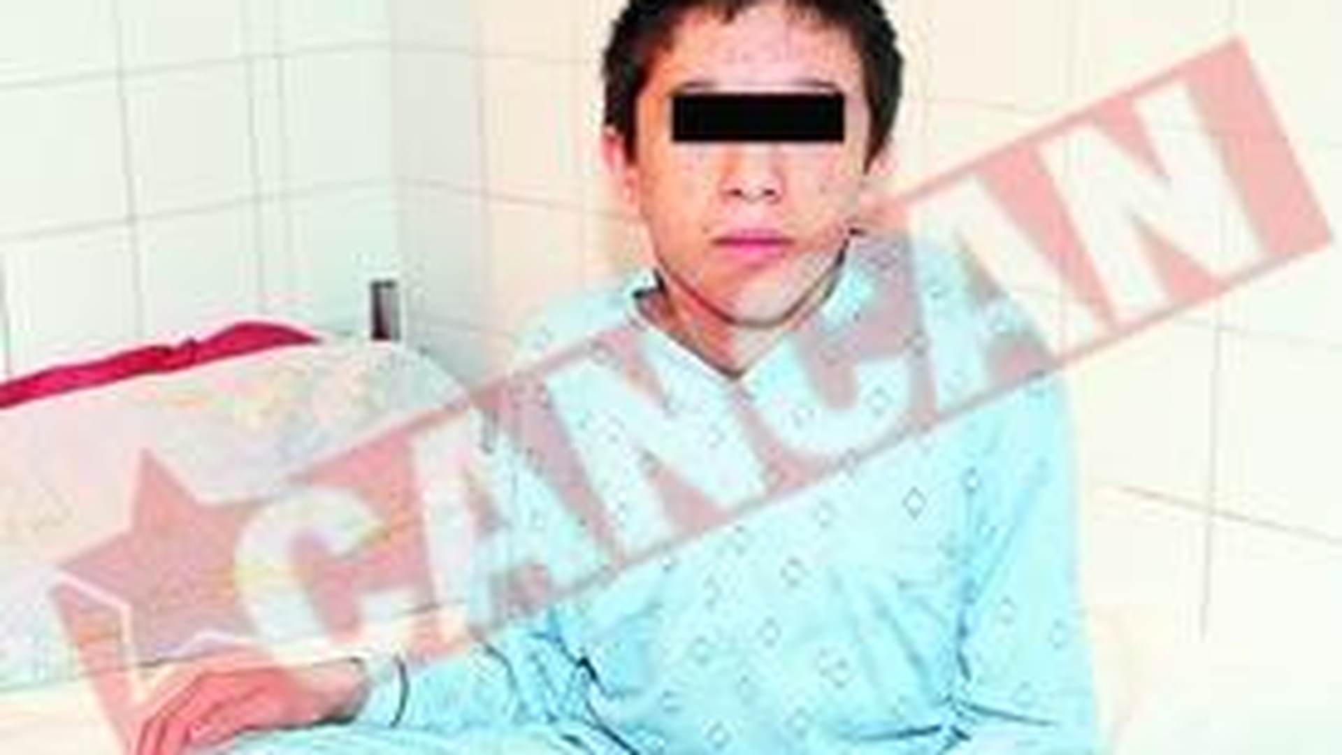 Un baietel cu cifoscolioza congenitala, salvat de medici