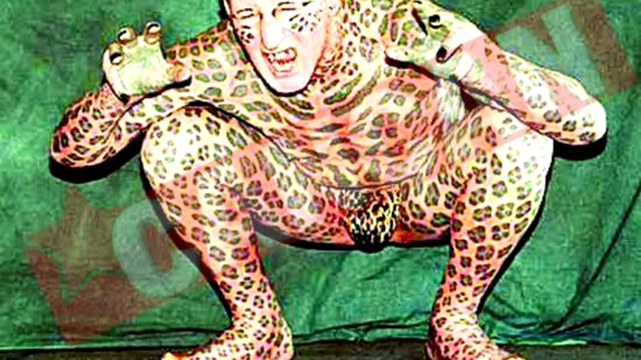 Omul-leopard traieste la azil