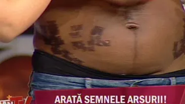 Video INCREDIBIL! Uite in ce hal a fost mutilata Laurette la salonul de infrumusetare - Are carne vie pe abdomen