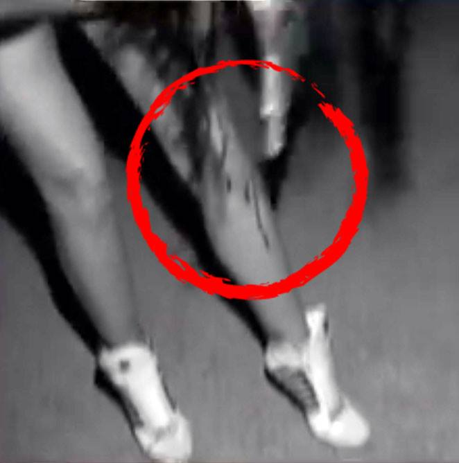 Brigitte s-a lovit la genunchi, în club la Mamaia