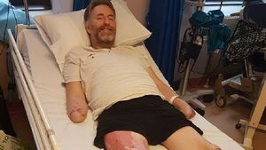 VIDEO / I-au fost amputate mâinile şi picioarele la o zi după ce a început să aibă simptomele unei răceli! Ce i s-a întâmplat, de fapt, bărbatului 