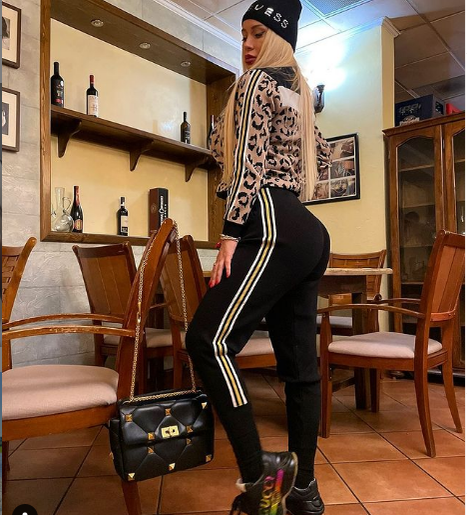 Simona Trașcă a trecut prin mai multe intervenții estetice