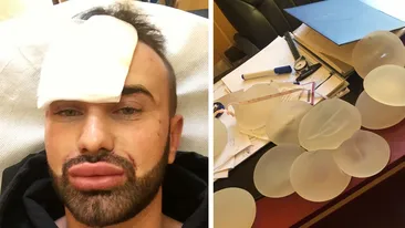 IMAGINI EXCLUSIVE! CONCHITA DE ROMÂNIA s-a decis! Şi-a operat faţa, iar acum îşi pune... SILICOANE!