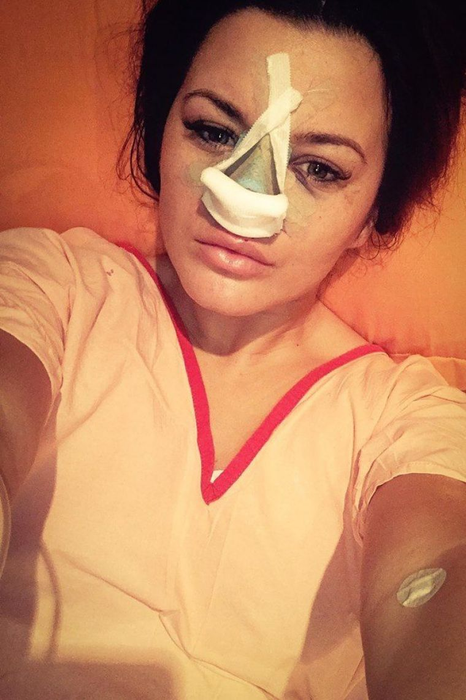 După ce și-a operat nasul, Carmen de la Sălciua, din nou în cabinetul medicului estetician. A ținut să se afle chiar de la ea