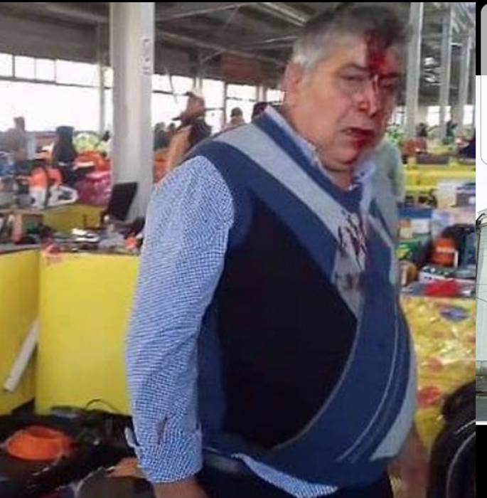 Bărbatul care s-a ales cu un topor în cap după confruntarea cu clanul