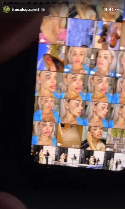 Bianca Drăgușanu a arătat din greșeală înregistrarea cutremurătoare în care este leșinată lângă pat: “Am trăit în casă cu un om care mă filma non stop! Nu ți se pare că ăsta e șantaj?!”