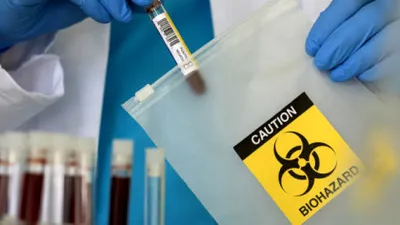 „Apocalipsa comandată prin poștă”. Epidemia de ciclosporiază din SUA expune pericolul unui viitor scenariu de coșmar: atacul biologic