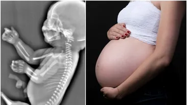 O tânară a aflat la ecografie că bebeluşul ei are o coadă în loc de picioare! Ce decizie a luat