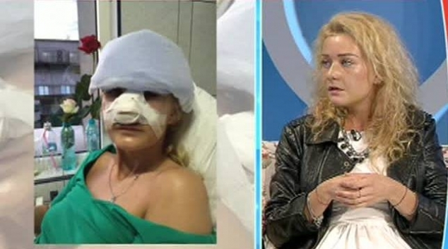 SANDRA, „blonda lui TUNCAY“, desfigurată! I-a dat cu piciorul în faţă, când pleca din club