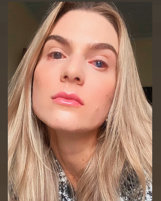 Această femeie a ajuns în comă, după ce a luat un medicament banal/ Sursa foto: Instagram