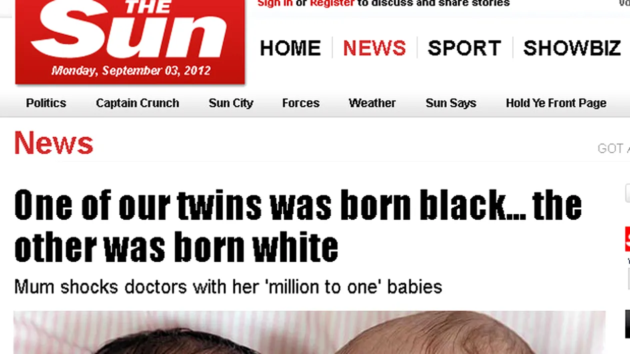 Un caz la un milion: s-au nascut gemene, dar una e neagra si una alba! Iar mama nu si-a inselat sotul! Vezi cum e posibil!