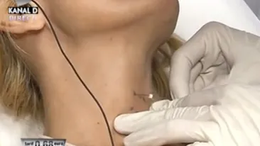 Ti se face pielea de găină! Daniela Gyorfi s-a lăsat injectată în gât in direct! Sper să nu ajung ca Michael Jackson