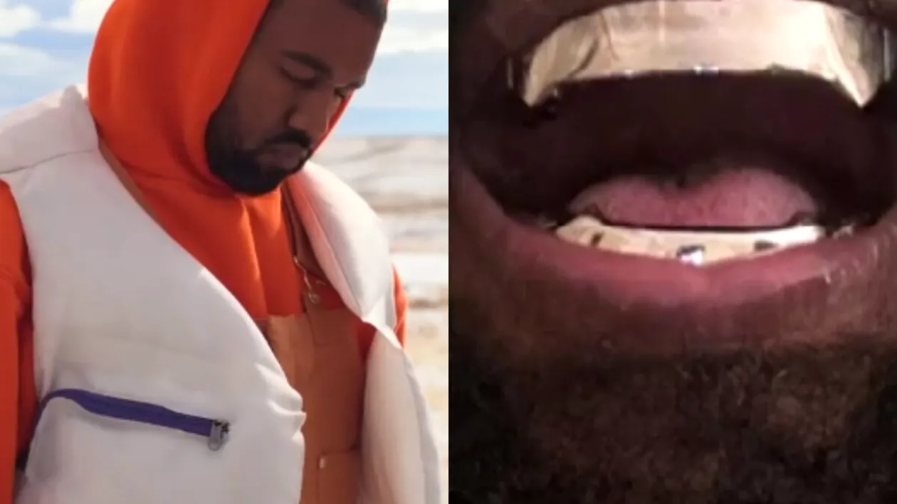 Kanye West și-a înlocuit toți dinții cu proteze de titan, în valoare de 850 de mii de dolari! Rapper-ul a avut ca model un film cu James Bond