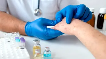 Ce simptome are lepra și cum se transmite, de fapt. Patru cazuri de boala Hansen au fost depistate la Cluj-Napoca