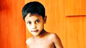 I-au scos fratele din burta