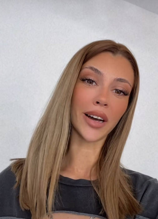 Mădălina de la Insula iubirii, intervenţie neaşteptată la nivelul feţei. Cum arată acum, după ce şi-a scos acidul din buze
