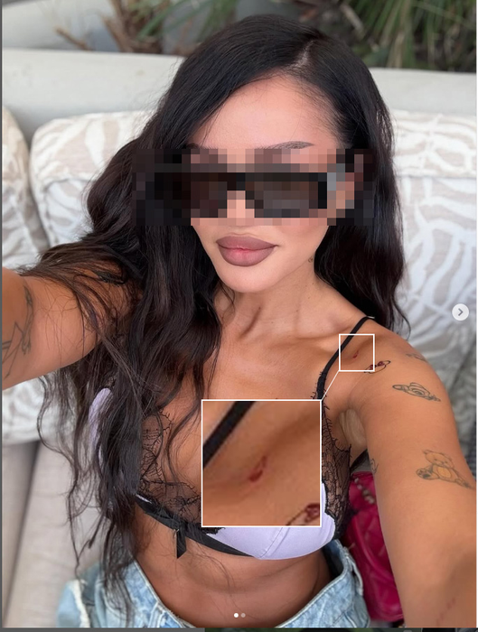 Tânăra și-ar fi tatuat inițiala lui Alex. (SURSA: SOCIAL MEDIA)