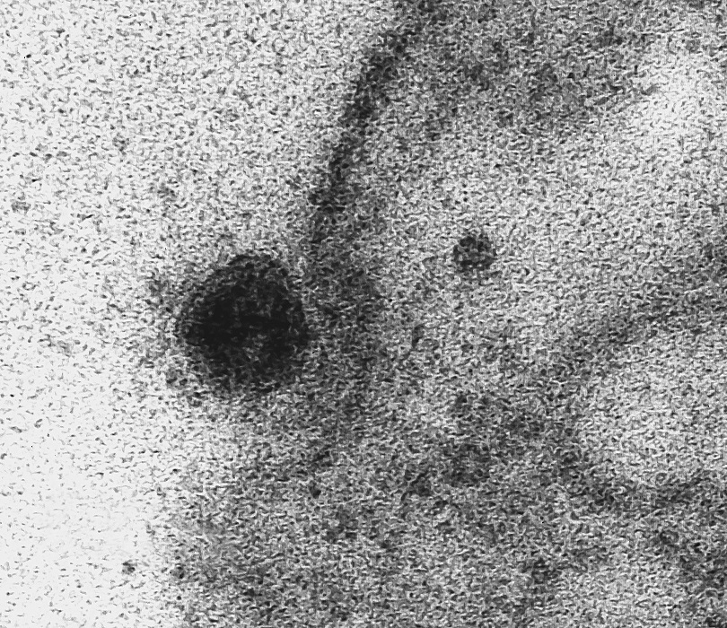 epa08351434 A handout picture made available on 08 April 2020 by the Oswaldo Cruz Foundation shows the SARS-COV-2 virus begin the infection process of cytoplasm of the cell, inside which is the nucleus, responsible for storing the genetic material of the cell. Brazilian scientists have captured images of the exact moment when the SARS-COV-2 virus infects a cell, the Oswaldo Cruz Foundation (Fiocruz) of Rio de Janeiro, Brazil, the largest medical research center in Latin America, reported on 08 April 2020. The photographs were taken with a transmission electron microscope during a study on the viral replication of SARS-CoV-2 and show in detail the contamination process of a cell, according to a statement from Fiocruz.  EPA/Débora Barreto / FIOCRUZ HANDOUT  HANDOUT EDITORIAL USE ONLY/NO SALES/NO ARCHIVES