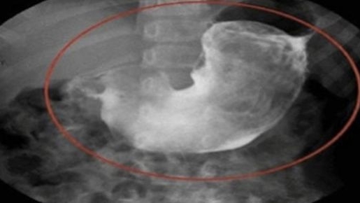 S-a dus la medicul ginecolog, iar diagnosticul a lăsat-o fără cuvinte! Ce a pățit o femeie care obișnuia să doarmă în pat cu pisicile ei